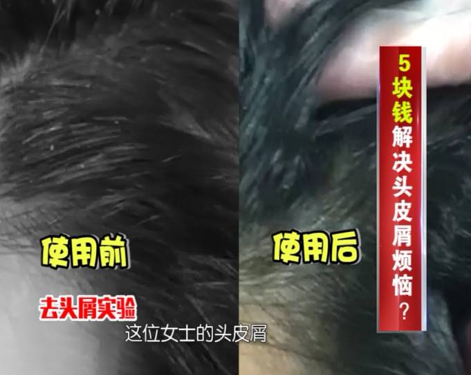 ‘太阳成集团tyc7111cc’北京进入手足口病高发时期(图1) 太阳成集团tyc7111cc